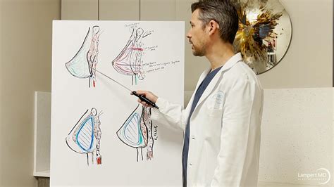 Breast Augmentation Miami | Breast Implant Surgeon Miami, FL