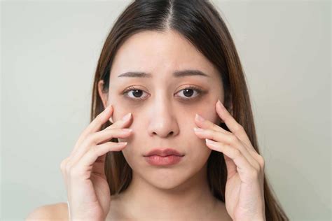 Banish Dark Circles: Secrets to Radiant, Youthful Eyes