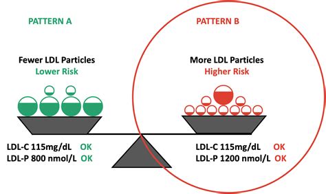 Discordance between LDL-C levels and LDL particle number