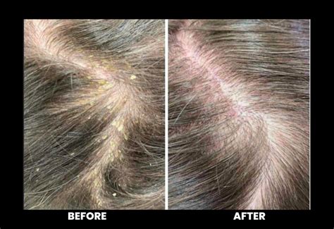 Buy ThriveCo Hair Care Kit: An Ultimate Kit for Healthy Scalp & Hair