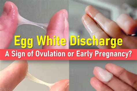 Egg White Cervical Mucus