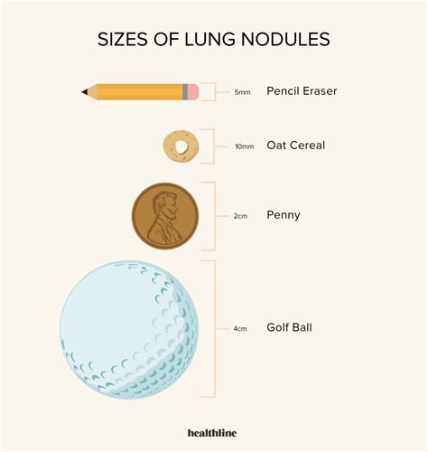 Can A Benign Lung Nodule Grow In Size at Daniel Kirkland blog