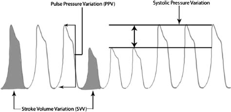 Optimizing Oxygen Delivery in the Critically Ill: Assessment of Volume ...