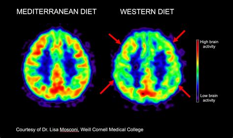 Pet Scan Vegetables at Murray Baxter blog