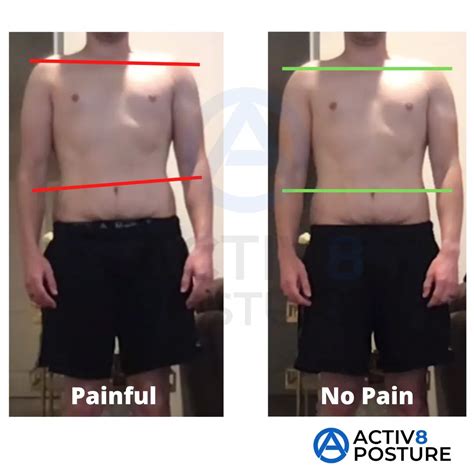 The Ultimate Guide on How to Correct Bad Posture & Relieve Pain
