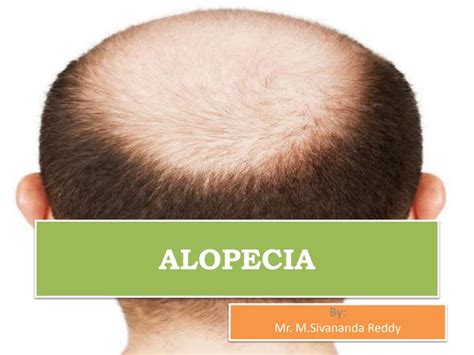 Image result for Alopecia Pronunciation Guide
