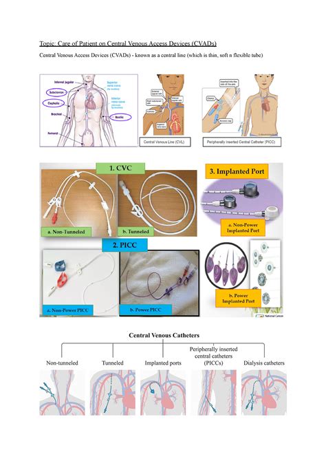 Central Venous Access Devices (CVADs) - Central venous catheter (CVC) a ...