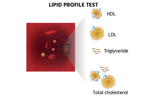 Affordable & Accurate Lipid Profile Test: Cost, Uses