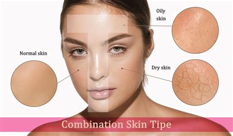what are ayurvedic products and their homemade remedies to treat oily ...