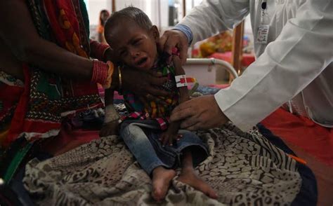 10 Shocking Facts About Malnutrition India Needs To Address Right Now