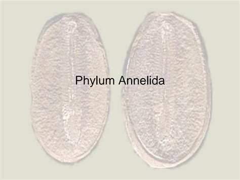 SOLUTION: Zoology phylum annelida - Studypool