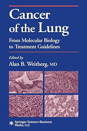 Buy Cancer of the Lung: From Molecular Biology to Treatment Guidelines ...