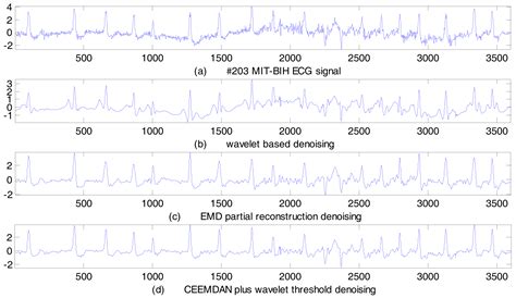 ECG Signal De-noising and Baseline Wander Correction Based on CEEMDAN ...