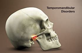Image result for Temporomandibular