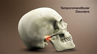 temporomandibular 的图像结果