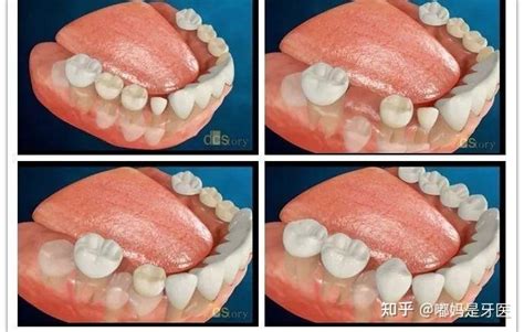 Image result for Filtering Process Slide