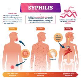 Image result for Syphilis Testing Algorithm Mayo