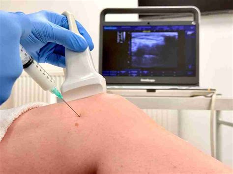 Injection Therapy 的图像结果