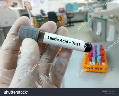 Test Tube Blood Sample Lactic Acid Stock Photo 1934819651 | Shutterstock