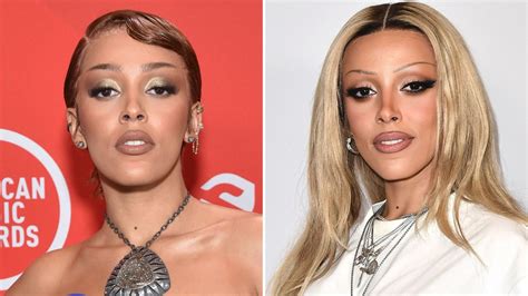 Doja Cat Plastic Surgery