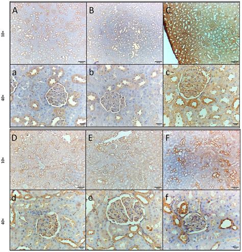 Gum Acacia–Dexamethasone Combination Attenuates Sepsis-Induced Acute ...