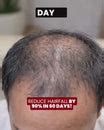 Biotin-Infused Hair Protein Mouthspray – Nutrispray