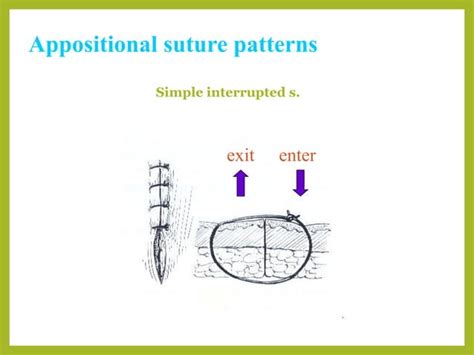 Image result for Continuous Suture Patterns