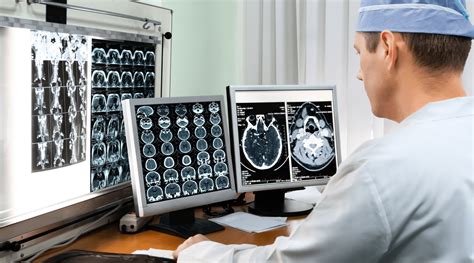 2 aspectos primordiais do PACS