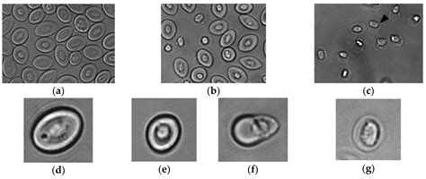 Shape-Shifted Red Blood Cells: A Novel Red Blood Cell Stage?