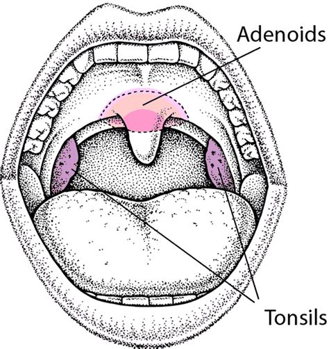 Image:Locating the Tonsils and Adenoids-MSD Manual Consumer Version