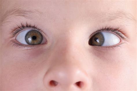 0-6岁儿童眼健康检查可以检查出哪些问题？_上海希玛瑞视眼科医院
