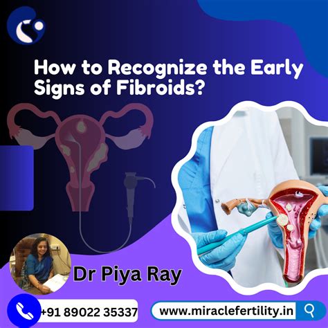 How to Recognize the Early Signs of Fibroids? - Miracle Fertility