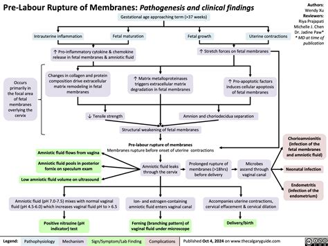 Spontaneous Rupture of Membranes | Calgary GuideCalgary Guide