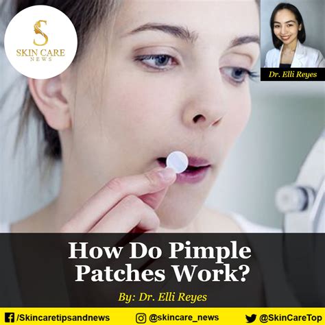 How Do The Patches Work at Michelle Baldwin blog