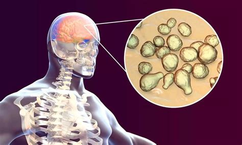 Kerala doctors treat first case of dual brain infection
