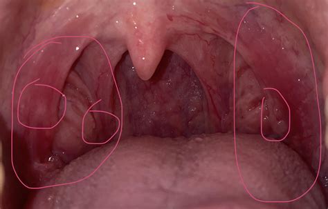 I quit smoking 2 months ago and since I quit my throat has been hurting on and off. Can someone ...