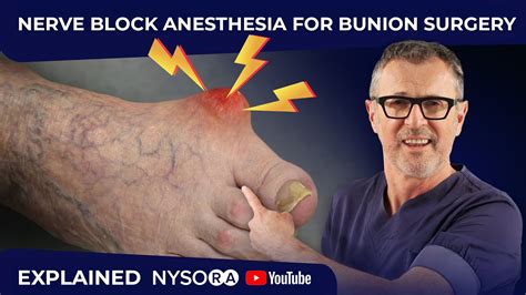 Local Anesthesia Blocks 的图像结果