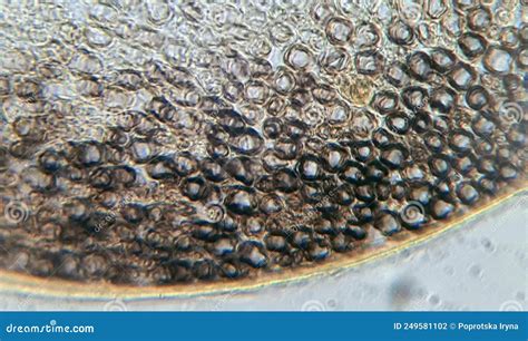 The Structure of the Myelin Nerve Fiber Under the Microscope Stock ...
