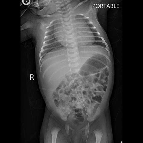Ultimax-i X-ray Clinical Gallery | Canon Medical Systems USA