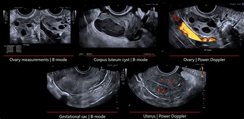 Canon Aplio flex купити в Україні | InMed