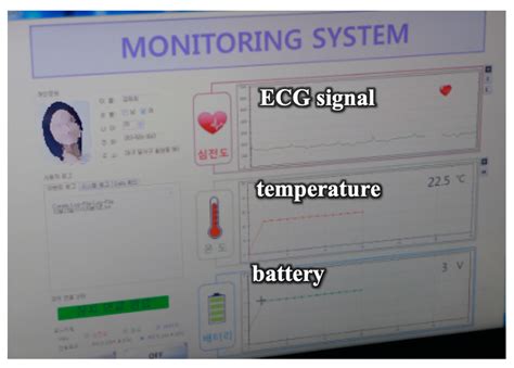 Development of ECG Monitoring System and Implantable Device with ...