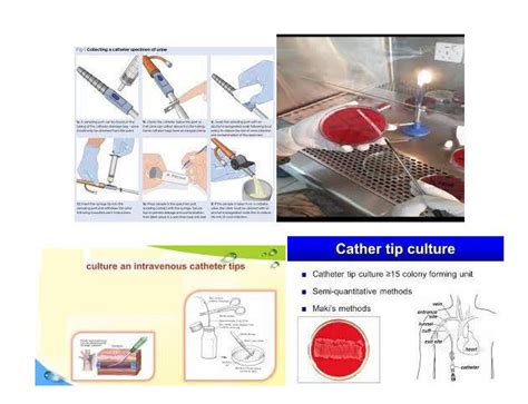 Image result for Tip Culture Methode Modification