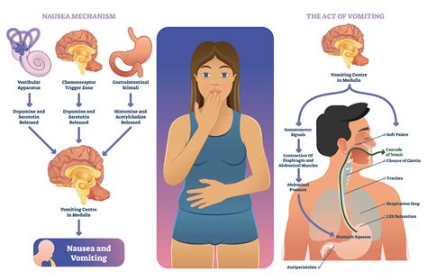 The Vomiting Centre and the Chemoreceptor Trigger Zone (CTZ) | Pharmacology Mentor
