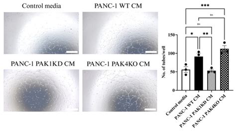 Targeting PAK1 or PAK4 Uncovers Different Mechanisms of Vascular ...