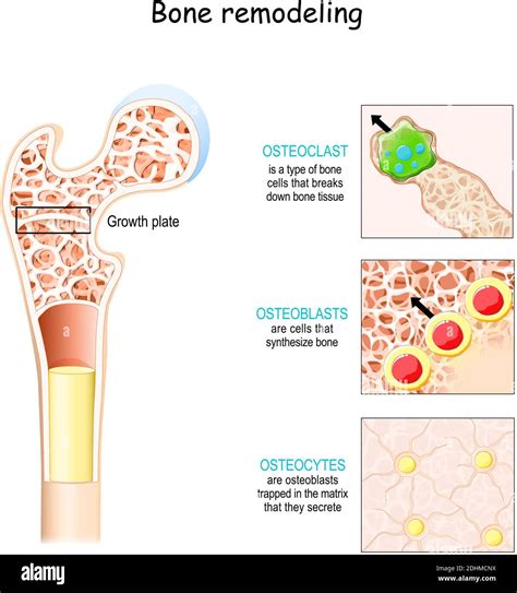 bone remodeling process (resorption, reversal, formation, and ...