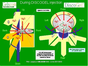 Image result for Disco Injection