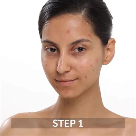 Buy salicylic acid face wash online at Fixderma – Fixderma Skincare