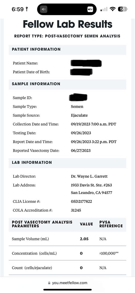 Amy good at home vasectomy tests : r/Vasectomy