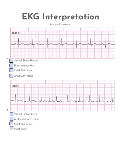 EKG Practice Course 的图像结果