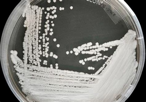 可怕！美国多地爆发超级真菌，近50%感染者90天内死亡… – 亚特兰大生活网